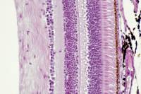 Rétine - vue d'ensemble montrant les photorécepteurs (cônes et bâtonnets) et la structure histologique CT x100